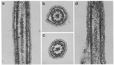 Thin section electron micrographs of Chlamydomonas reinhardii strain... | Download Scientific ...