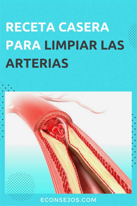 Arterias Obstruidas: Receta de Remedio Casero Healthy Tips, Healthy Drinks, Home Remedies ...