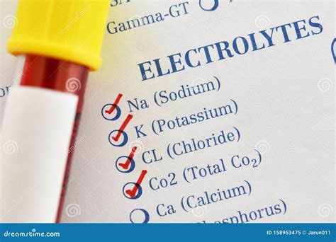 Blood Sample Tube for Electrolyte Test Stock Image - Image of checkup ...