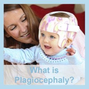 Plagiocephaly: Causes, Symptoms & Treatments | Treatment, Flat head syndrome, Infancy