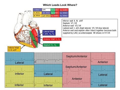 Sinus Tachycardia, Ventricular Tachycardia, Wolff Parkinson White Syndrome, Cardiovascular ...