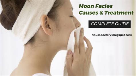 Moon Facies: Causes and Treatment ~ Home Doctor