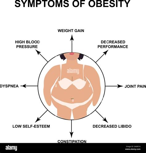 Symptoms of Obesity International Day Against Obesity. Infographics ...