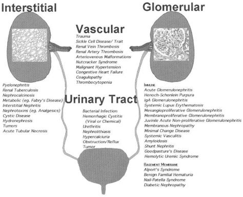 HEMATURIA IN CHILDREN - Pediatric Clinics