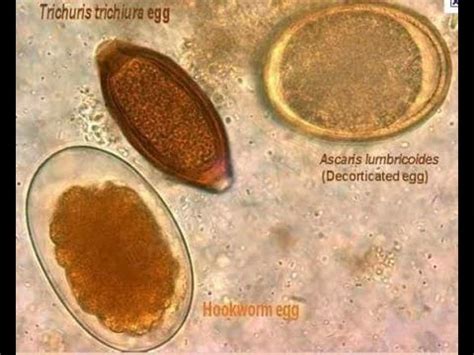 parasites seen from the microscope - YouTube