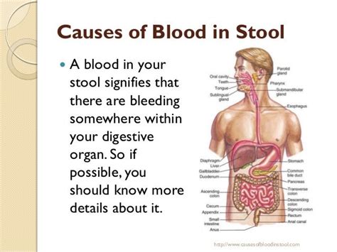 Causes of blood in stool