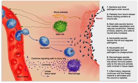 Inflammatory Response