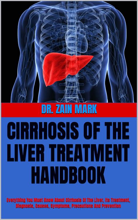 Buy CIRRHOSIS OF THE LIVER HANDBOOK: Everything You Must Know About ...