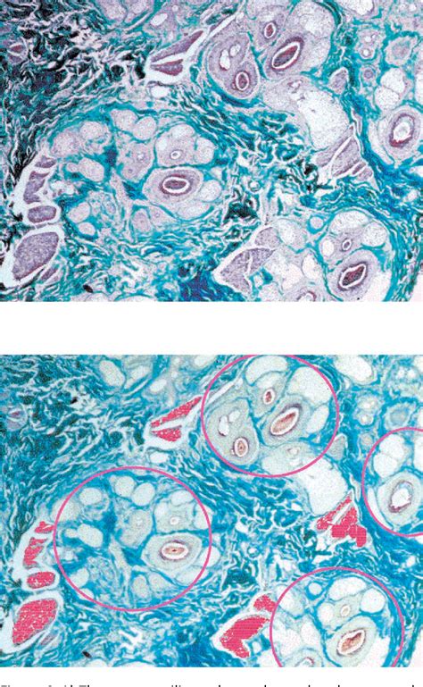 Piloerector Muscle Histology