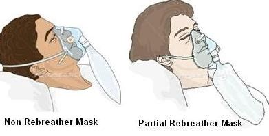 Non re-breathing mask