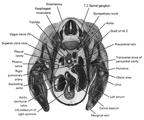 Semilunar Ganglion