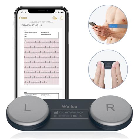 Portable EKG Monitor - Instant EKG Analysis with APP – Wellue Health.