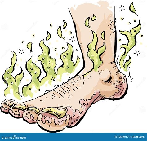 Stinky Infected Foot Rash stock vector. Illustration of stench - 126140171