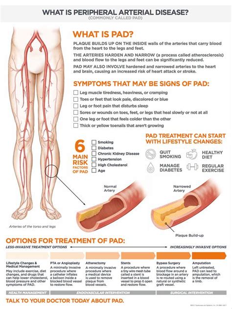 What is Peripheral Arterial Disease? Modern Vascular | Peripheral artery disease, Nursing school ...