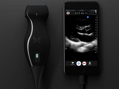 Butterfly IQ - Ultrasound Anywhere, Anytime - Electronics-Lab.com