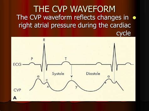 PPT - CENTRAL LINES AND ARTERIAL LINES PowerPoint Presentation, free download - ID:5731044