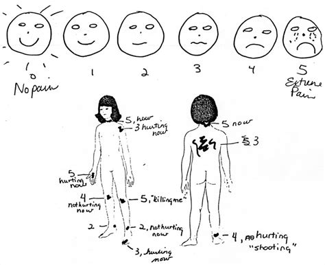 History of the Wong-Baker FACES® Pain Rating Scale | Wong-Baker FACES® Foundation