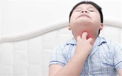 Symptoms of Food Allergies in Children - HealthXchange