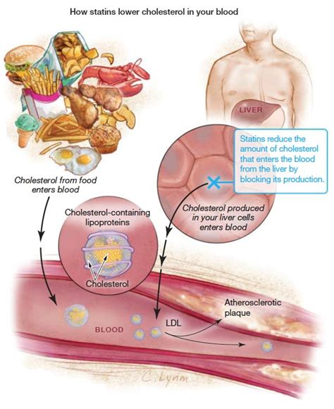 Statins - Not Just For Cholesterol