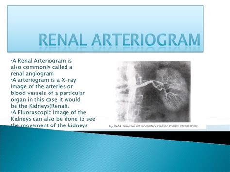 Renal Arteriogram