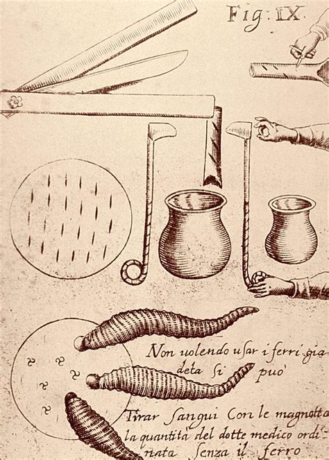 Blood-letting Instruments Photograph by National Library Of Medicine ...