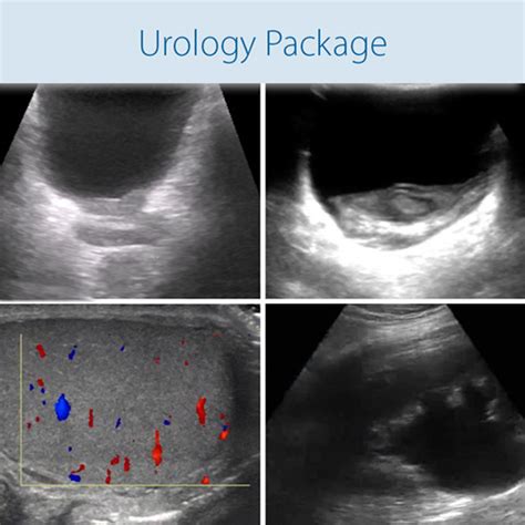 Scrotum Anatomy - Scrotum Ultrasound