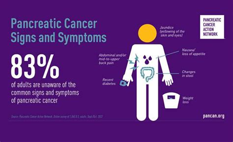 Most U.S. Adults Are Unaware Of The Signs And Symptoms Of Pancreatic Cancer According To New ...