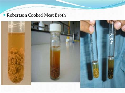 Anaerobic Culture Methods