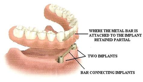 Dental Plate - Dental News Network