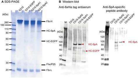 Free photo: Gel electrophoresis - Acids, Genetic, Sequencing - Free Download - Jooinn