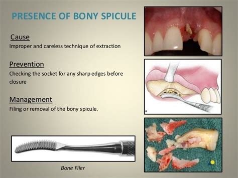 Pin on Oral Surgeon Humor