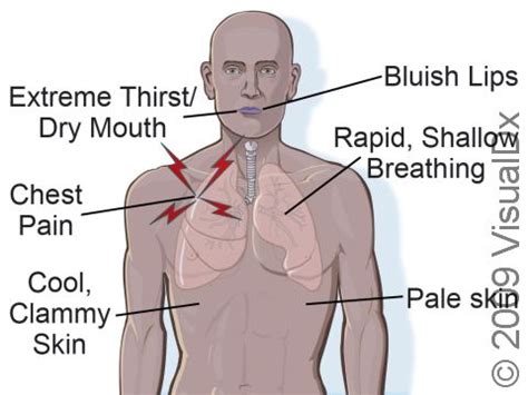 Medical Shock Symptoms