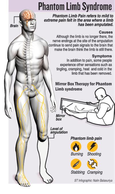 When the pain lingers | The Sunday Times Sri Lanka