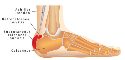 Achilles Tendon (Human Anatomy): Function, Location, and Injuries – Injury Health Blog