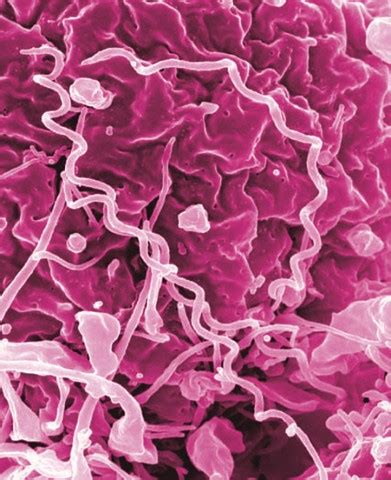 Syphilis Bacteria | Treponema pallidum, the bacteria that ca… | Flickr