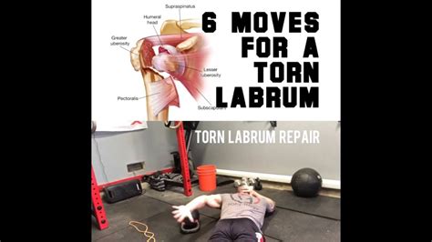 6 Moves for a Torn Shoulder Labrum | SmashweRx | Trevor Bachmeyer - YouTube