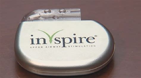 Implantable device offers relief for severe cases of sleep apnea | WBMA