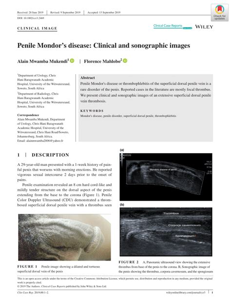 (PDF) Penile Mondor’s disease: Clinical and sonographic images