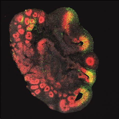 Brain organoids provide insights into the evolution of the human brain