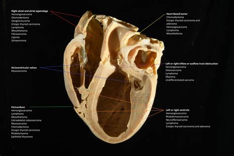 Is A Dog Heart On The Right Or Left