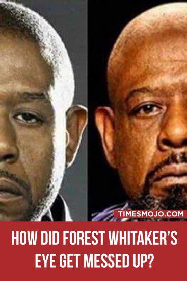 How did Forest Whitaker's eye get messed up? - TimesMojo