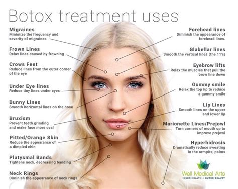 Botox® is a brand name of an FDA-approved injection which is made of a neurotoxin called ...