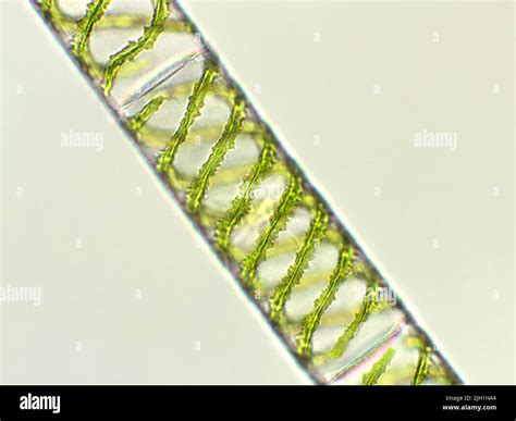 Structure Of Oedogonium With Diagram Chlorophyta