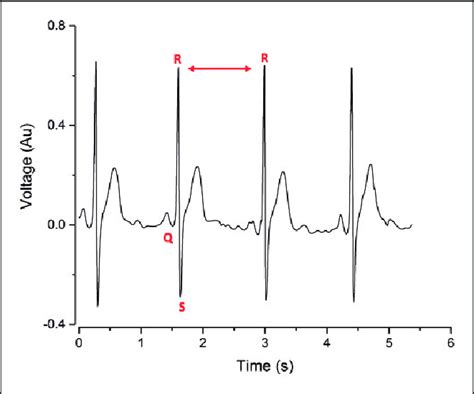 Electrocardiogram demonstrating the interval between R waves. Heart... | Download Scientific Diagram