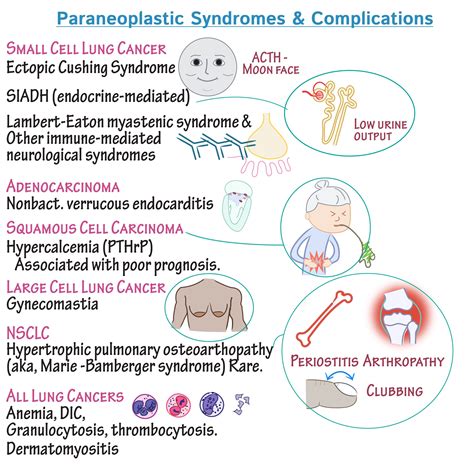 Dermatomyositis Paraneoplastic Syndrome