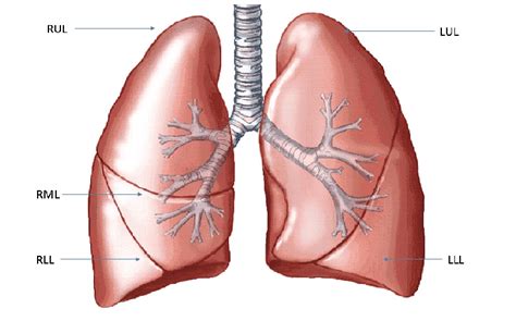 Schematic of a human lung with its five lobes. RUL = right upper lobe,... | Download Scientific ...