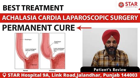 Achalasia Cardia Best Treatment in Nawanshahr | Laparoscopic Cardiomyotomy Surgeon in Nawanshahr ...