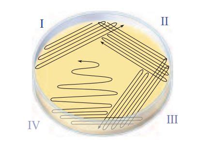 Streak Plate - SCIENTIST CINDY | Medical laboratory science, Medical laboratory technician ...