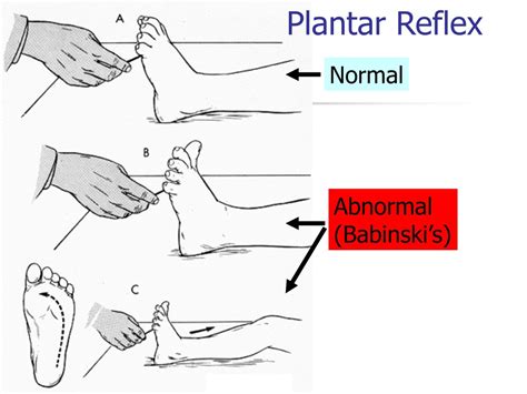 PPT - Reflexes Interactive (pgs.439-446) PowerPoint Presentation, free download - ID:403001