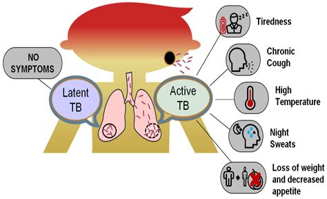 Electronics | Free Full-Text | Evolution of Machine Learning in Tuberculosis Diagnosis: A Review ...